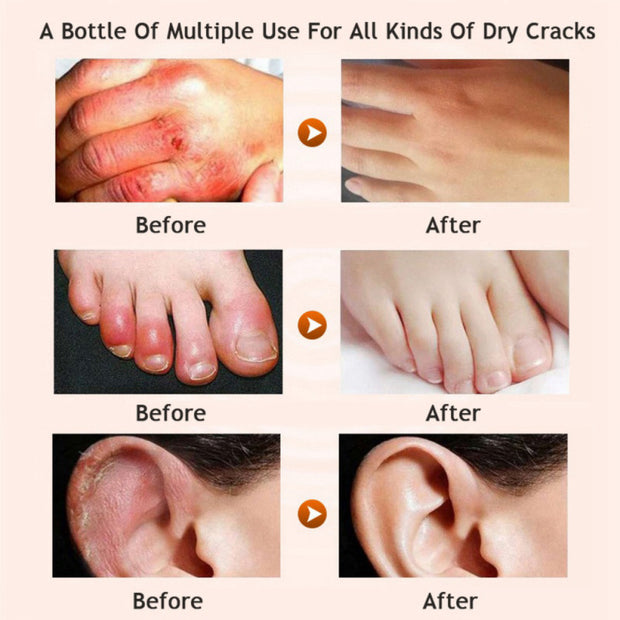 Honey Moisturizing Foot & Leg Cream Softening Hydration Care