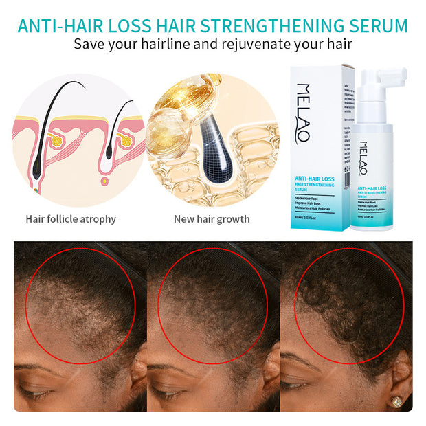 Hair Growth Liquid Scalp Care & Strengthening Serum