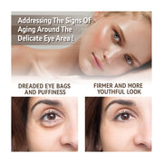 Moisturizing Eye Cream  Dark Circles & Puffiness Care