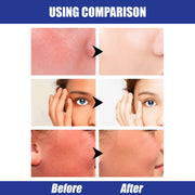 SPF50 Sun Block Stick Lightweight & Waterproof Hyaluronic Acid Protection