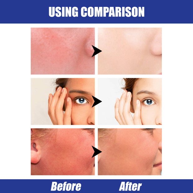SPF50 Sun Block Stick Lightweight & Waterproof Hyaluronic Acid Protection
