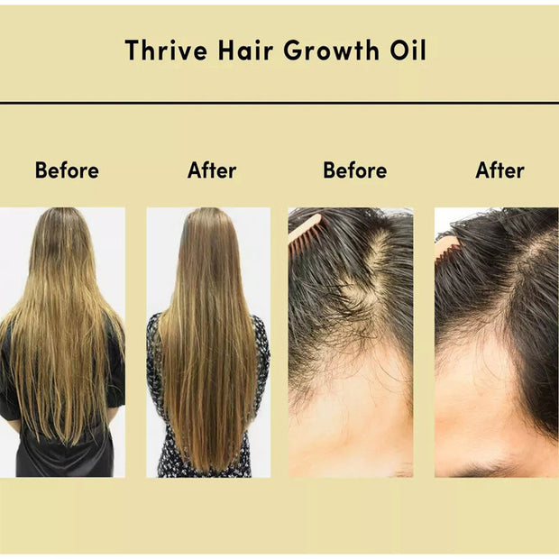 Nourishing Hair Essential Oil Hydrates & Repairs Dry Scalp