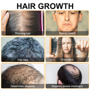 Hair Growth Serum  Scalp Moisturizer & Hair Loss Prevention