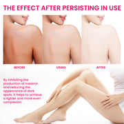 Pigmentation Care Cream  Women’s Skincare Treatment