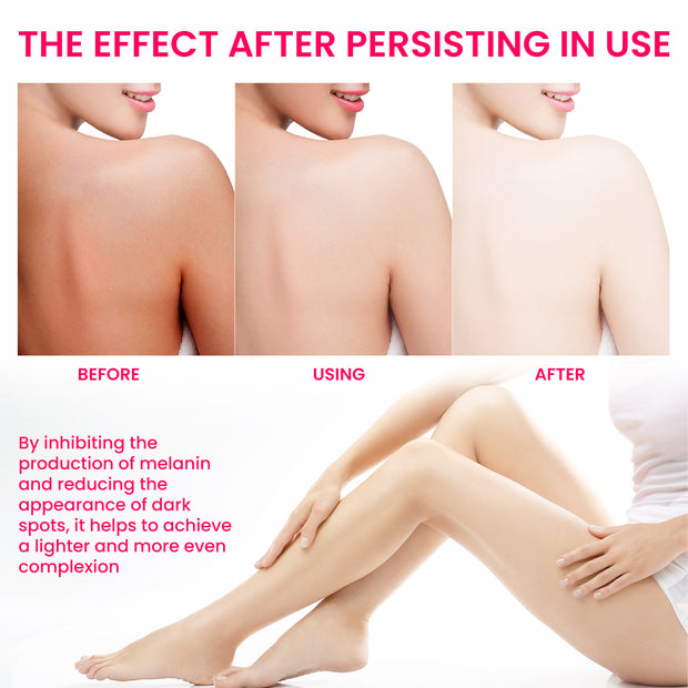 Pigmentation Care Cream  Women’s Skincare Treatment